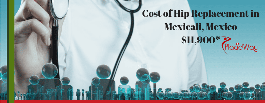 Hip Replacement in Mexicali, Mexico